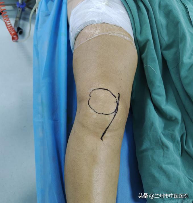 兰州市中医骨伤科医院,兰州中医骨伤科医院康复科