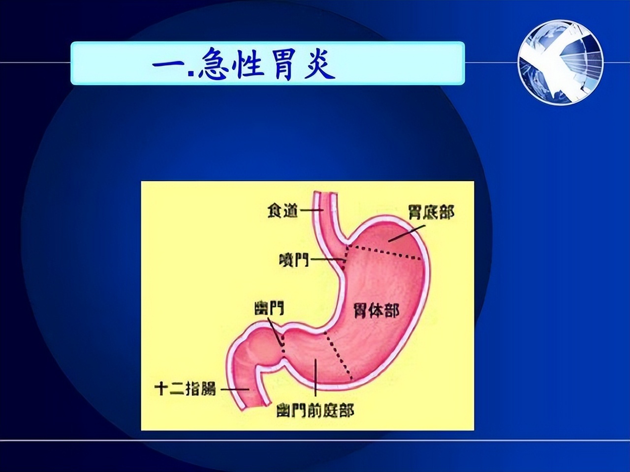 非萎缩性胃炎伴糜烂吃奥美拉唑吗,非萎缩性胃炎伴糜烂能吃奥美拉唑