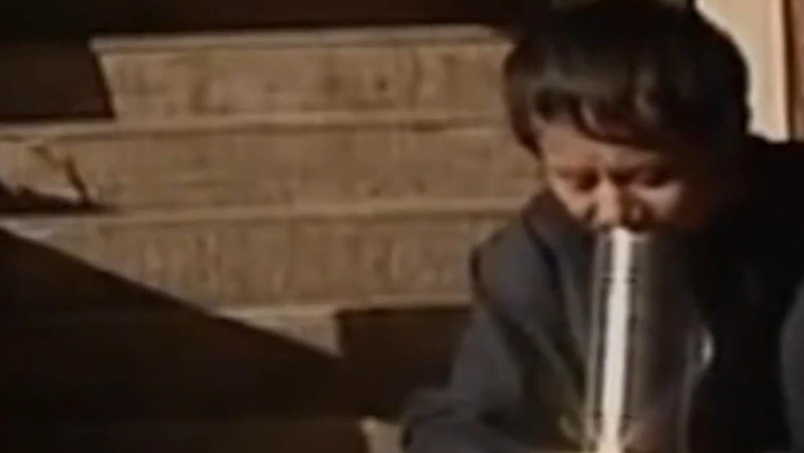 云南男子口臭手术后现在怎么样了,云南男子口臭查出了大毛病