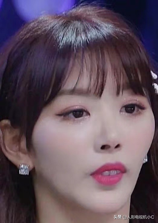 刘涛做的是全瓷牙还是烤瓷牙,刘涛做烤瓷牙的前后对比图