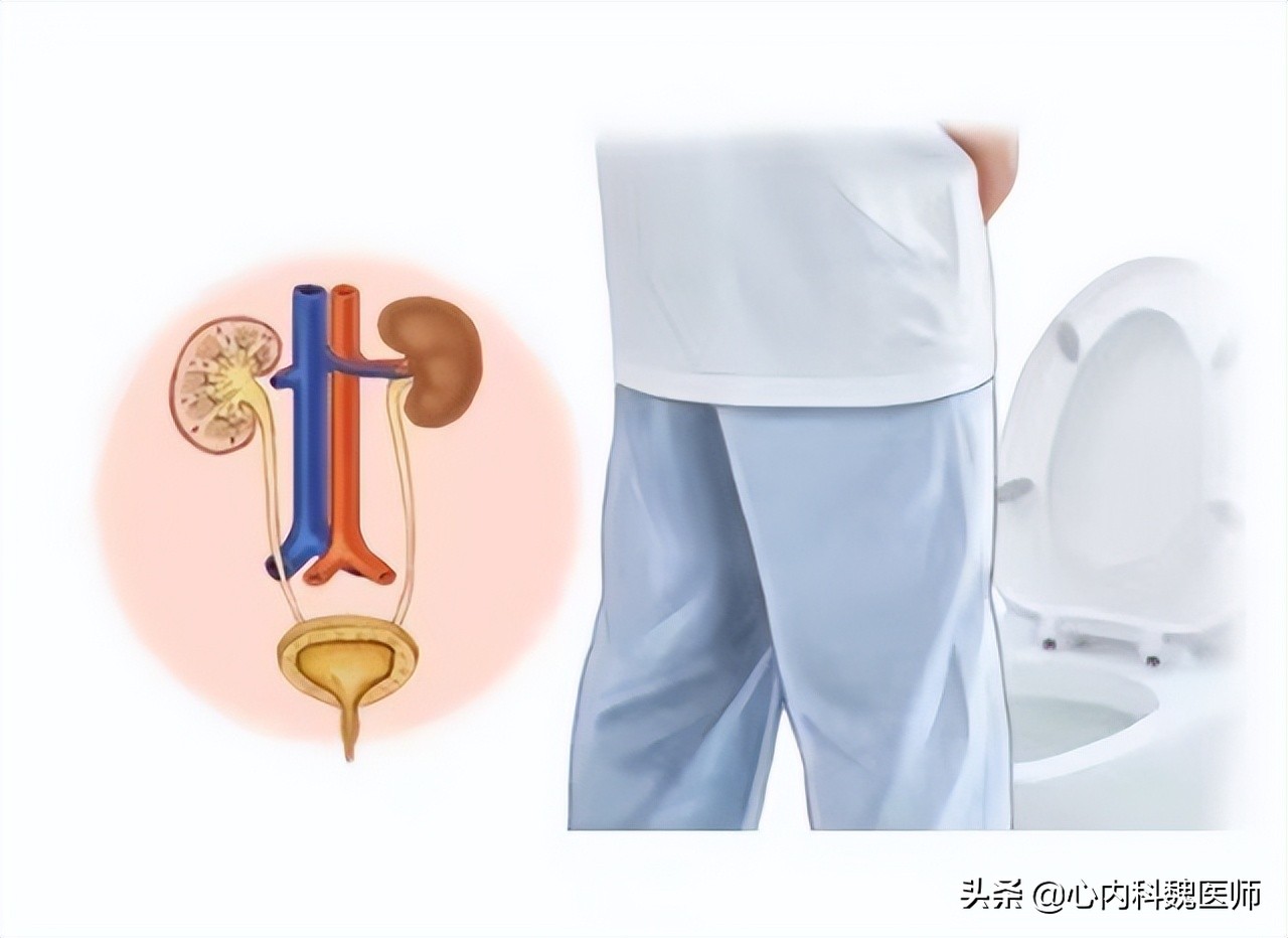 吃什么降压药会引起缺钾,吃降压药导致缺钾身体8个症状