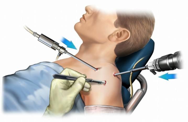 肩膀疼运动一下,运动肩膀疼痛怎么治疗最快最好