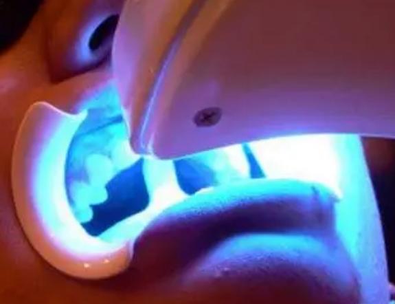 牙齿变黄口臭三分钟搞定,如何能快速解决牙齿口臭口黄