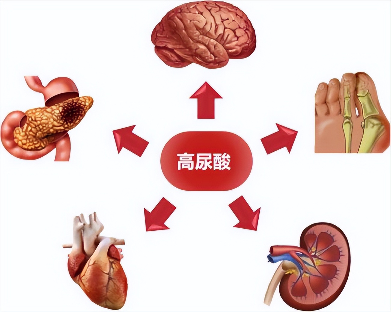 吃高嘌呤食物尿酸一般多久消失,哪些蔬菜嘌呤低尿酸高的人可以吃