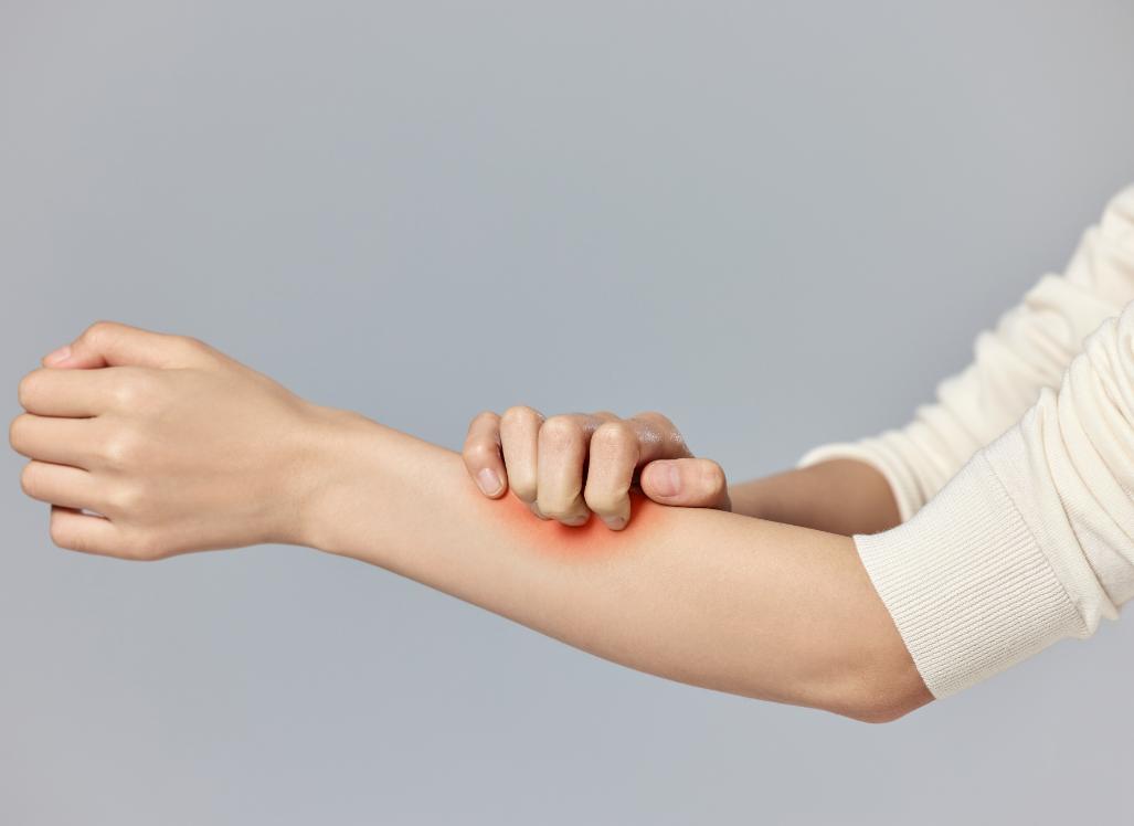 瘙痒过敏吃什么过敏药,过敏导致皮肤瘙痒应该怎么办