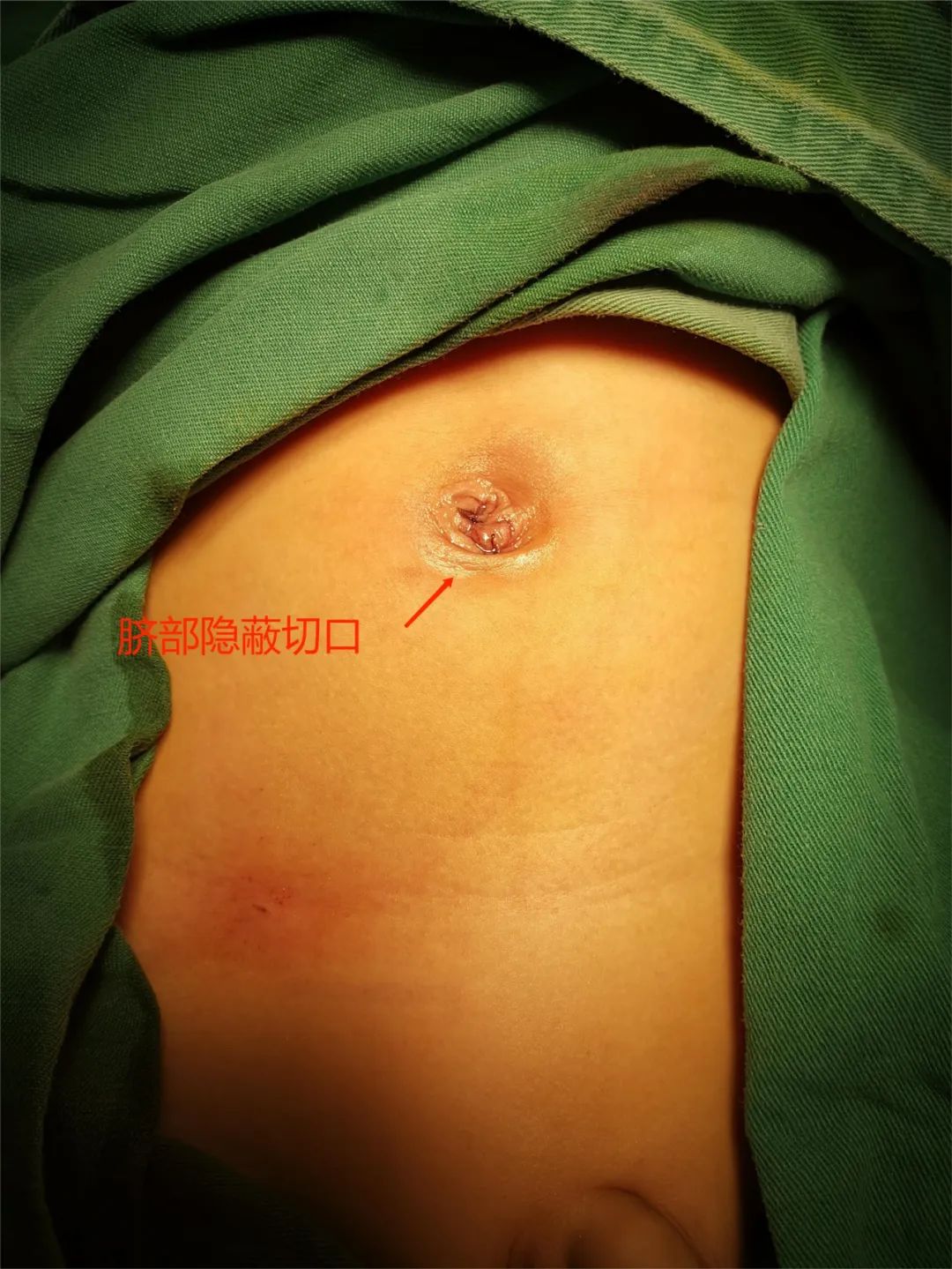 江西儿童医院泌尿科专家门诊,江苏省人民医院儿童泌尿外科