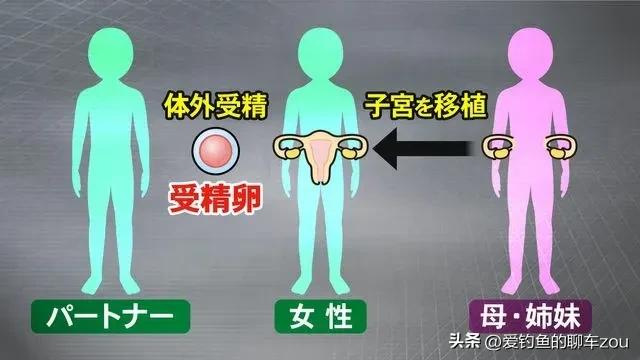 国外子宫移植普遍吗,日本器官移植手术