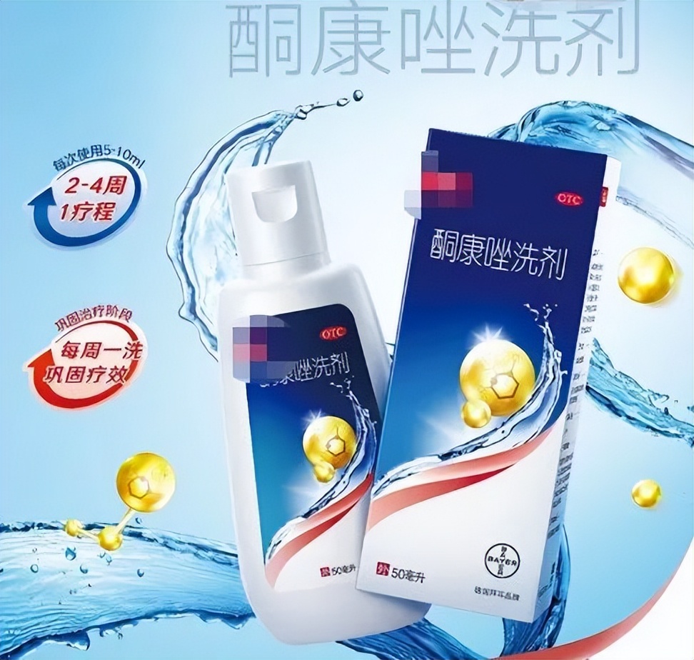 冬天头皮屑多又痒怎么回事,为啥一到冬天头皮屑多还痒