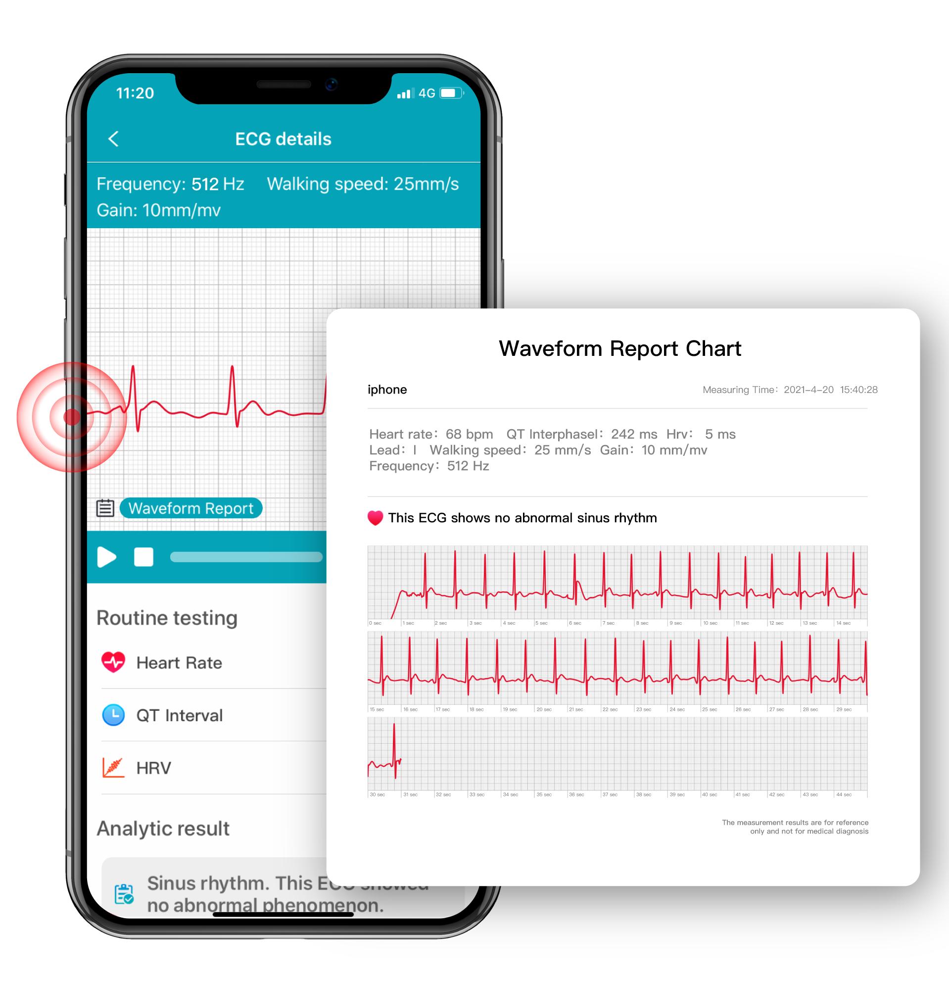 老年人有必要使用智能手表吗？
