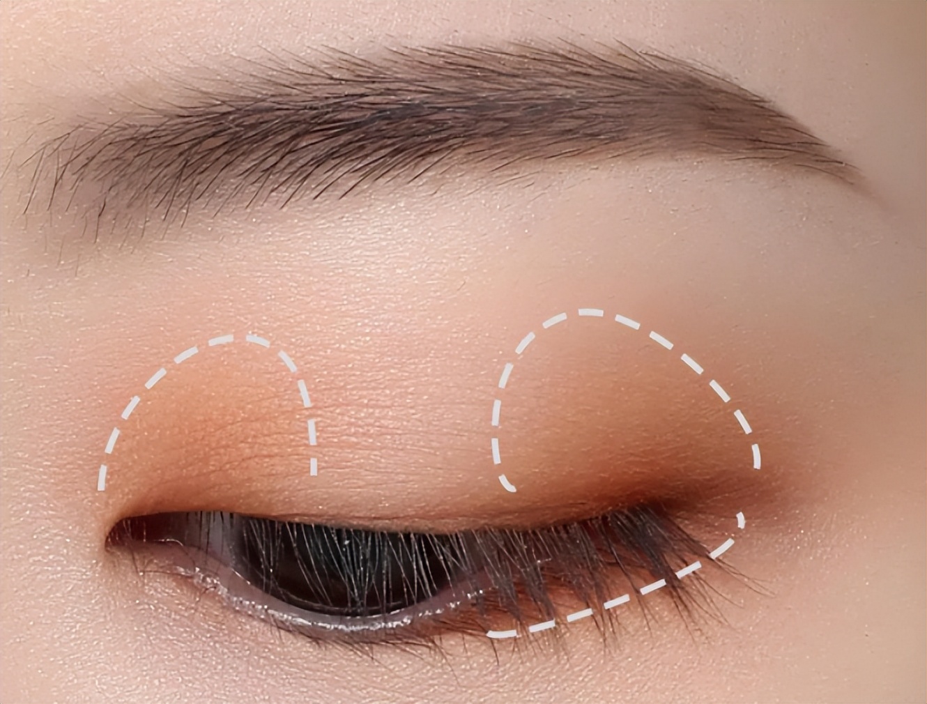 单眼皮肿眼泡如何不贴双眼皮消肿,单眼皮肿眼泡怎么消肿最快