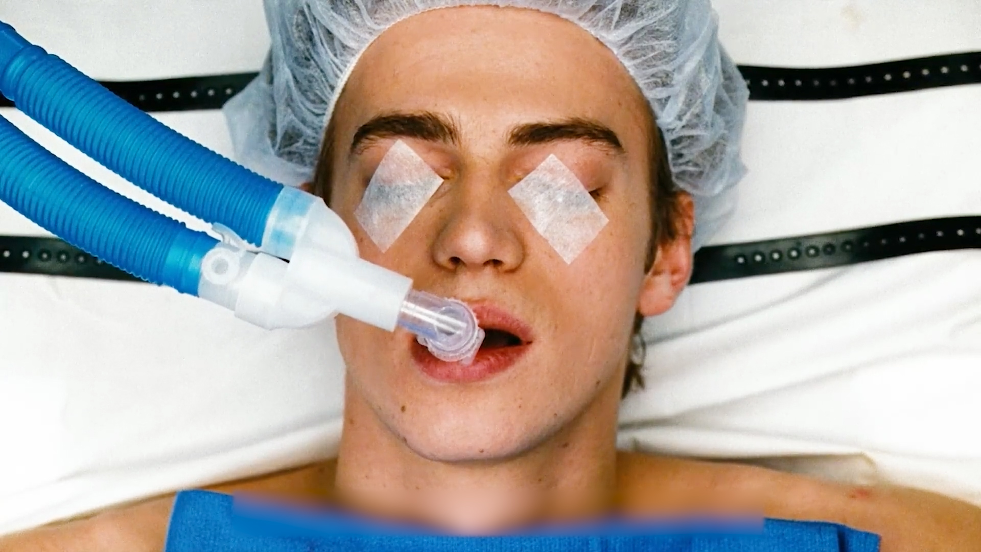 换瓣手术麻醉后遗症,换心手术并发症