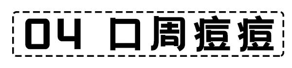 面部危险三角区反复起痘痘怎么办,脸颊周围痘痘的正确消除方法