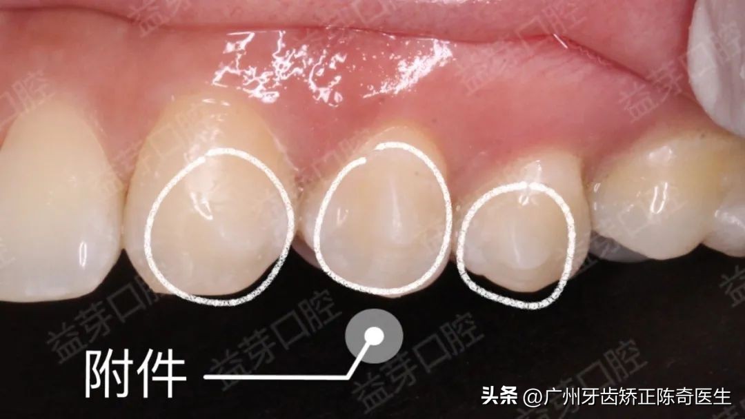 鎴寸墮濂楁湡闂翠綘閮介亣鍒拌繃鍝簺鍥伴毦,瀵规姉emo