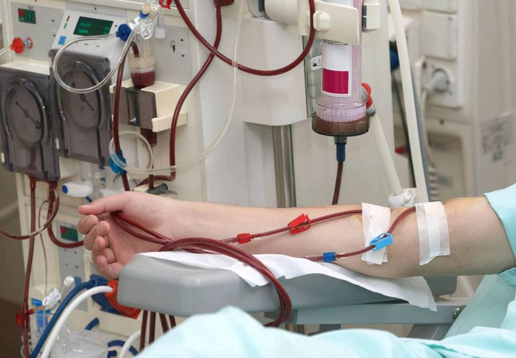 吃他汀降血脂要警惕三类副作用,吃他汀期间这四种东西要远离