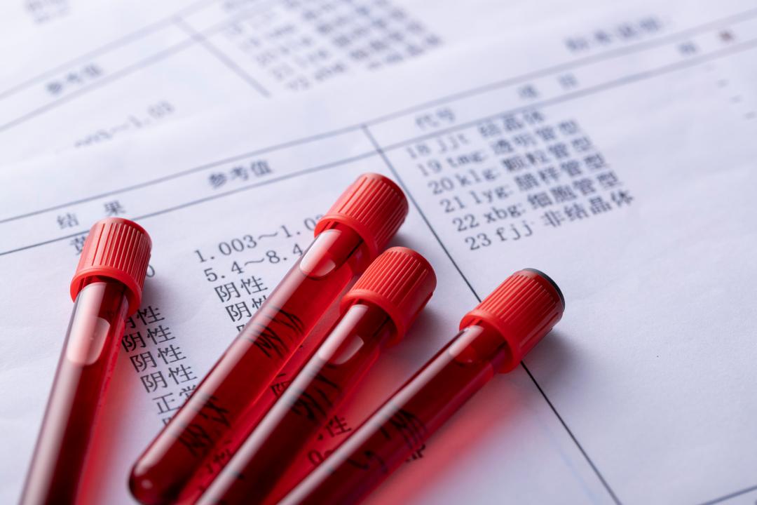 癌胚抗原升高3倍，你真正该在意的是这几点