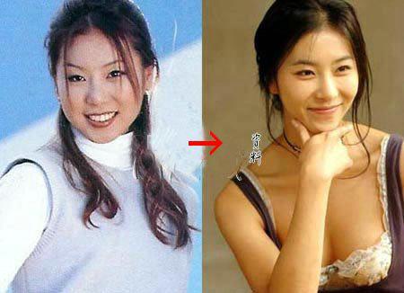 有关整容的韩剧女明星,韩剧女主整容前后对比