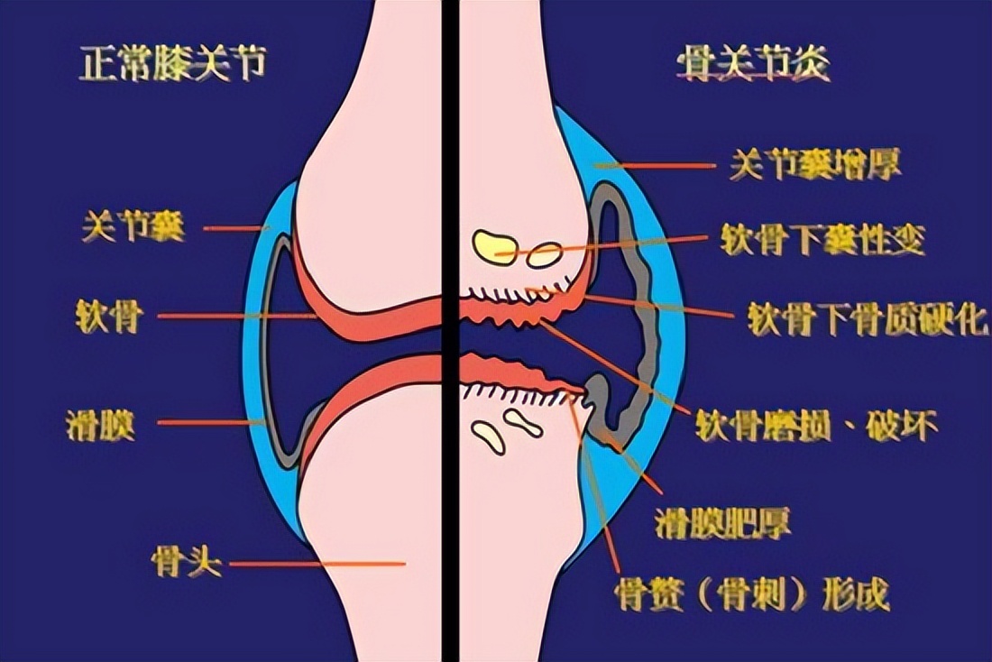 腿脚酸软无力的原因和解决方法,腿脚无力是什么原因