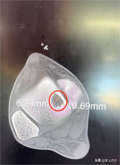 西宁市第三人民医院外科,西宁第三人民医院扩建项目
