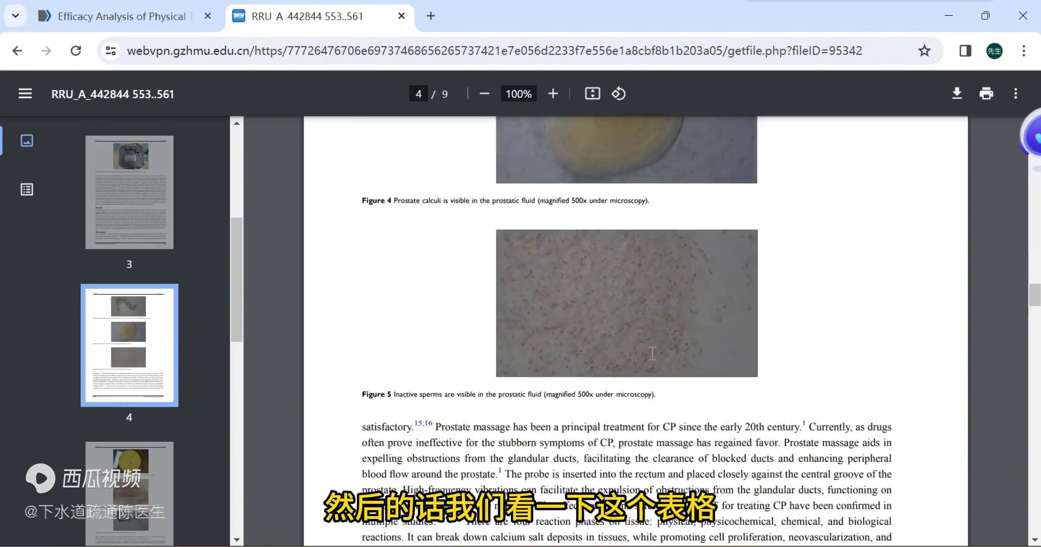 腺管疏通,前列腺炎腺管疏通治疗靠谱吗