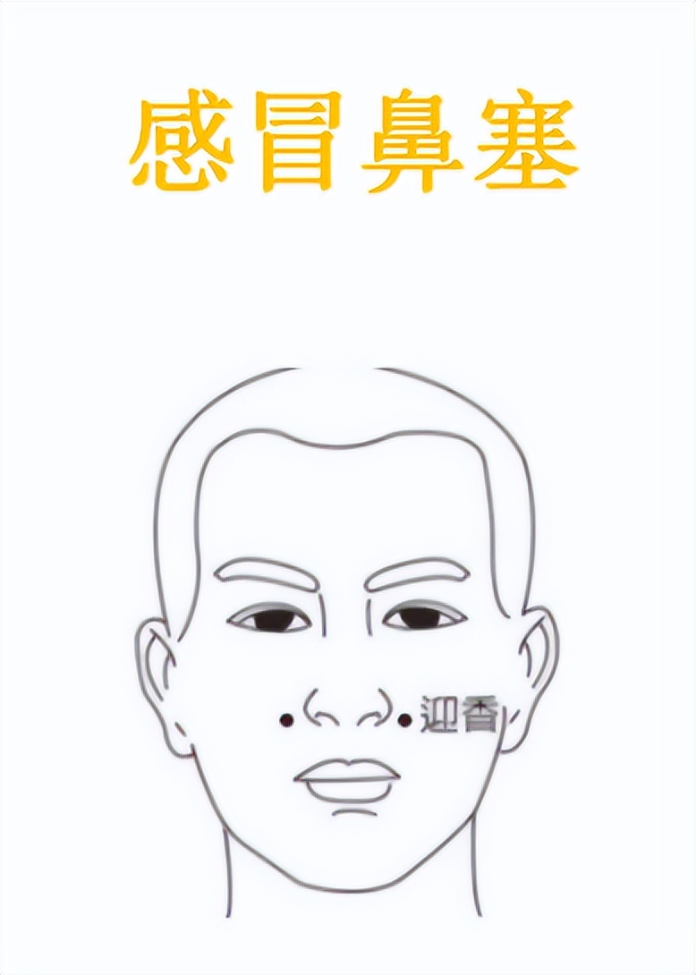 人体经络穴位高清图解大全，收好了，按摩艾灸、拔罐刮痧都用得到