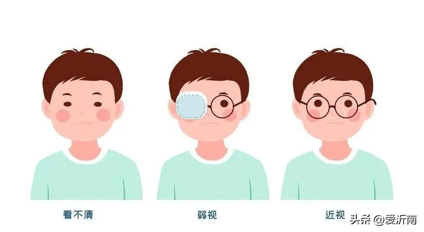 孩子两只眼睛度数相差100度,左右眼度数相差100