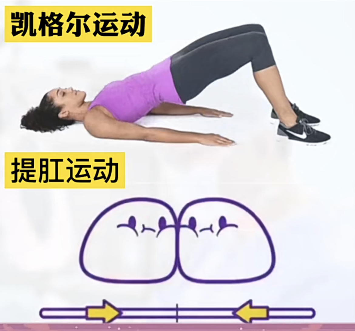 产后漏尿多长时间可以锻炼修复,产后漏尿怎么修复才好