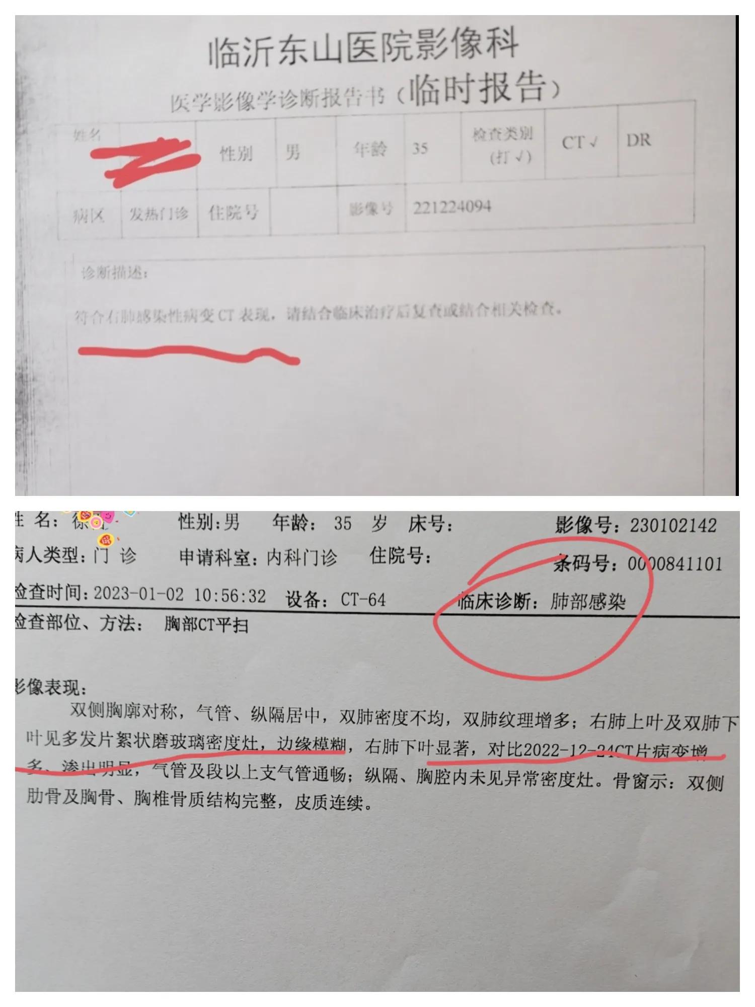 新冠阳了之后咳嗽喘不过气,新冠阳性后咳嗽乏力