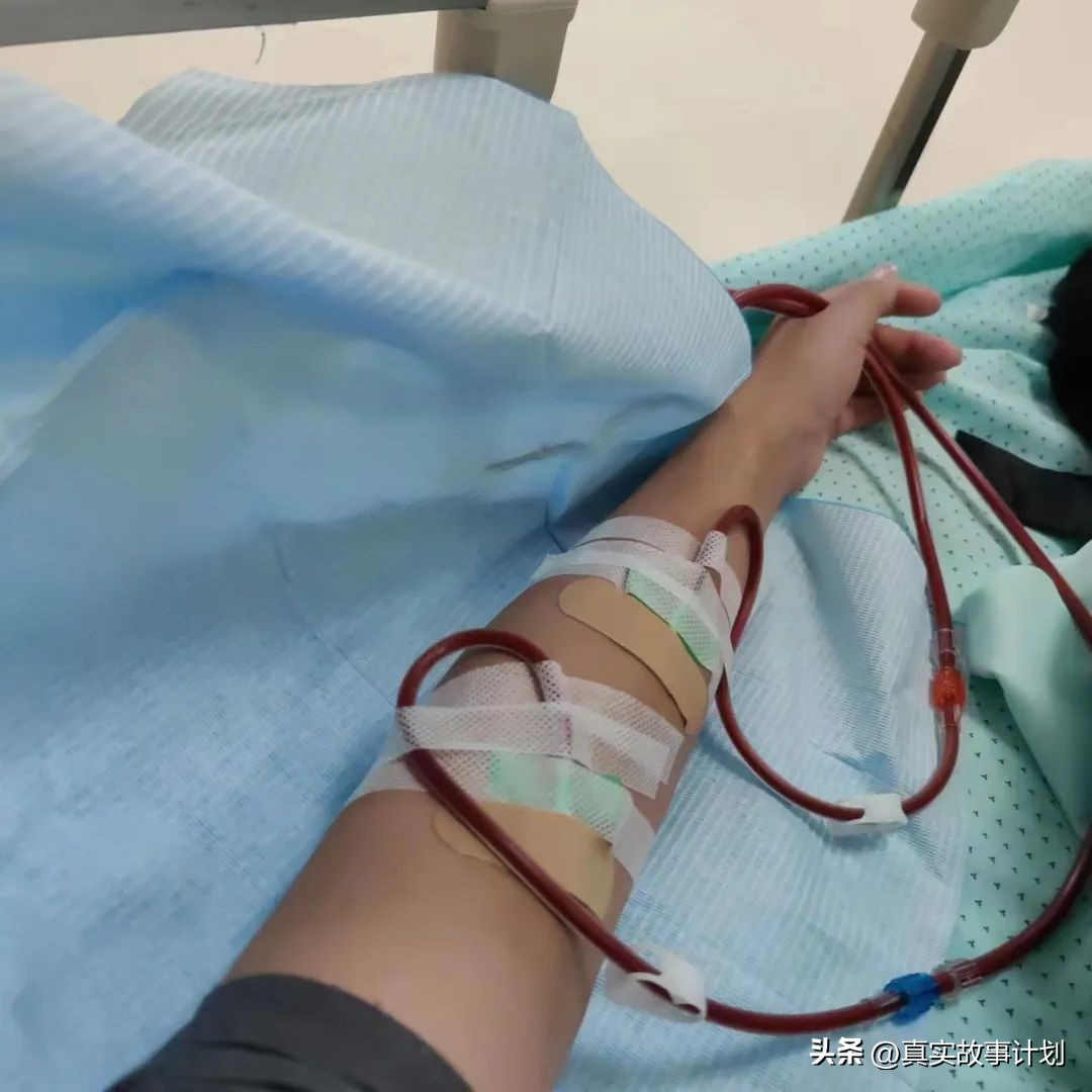 透析病人端脑,透析病人狂躁抽搐