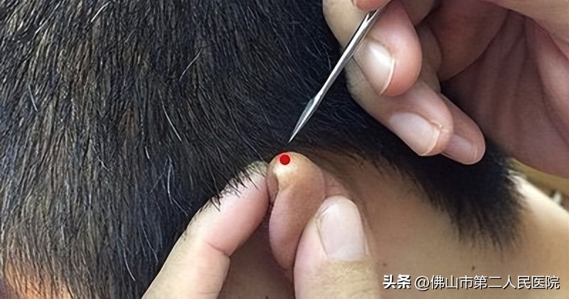 一笑起来面部肌肉抽搐,老年人面部肌肉抽搐是怎么回事