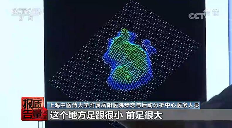 儿童足外翻硬鞋底还是软鞋底好,软鞋底会导致扁平足吗