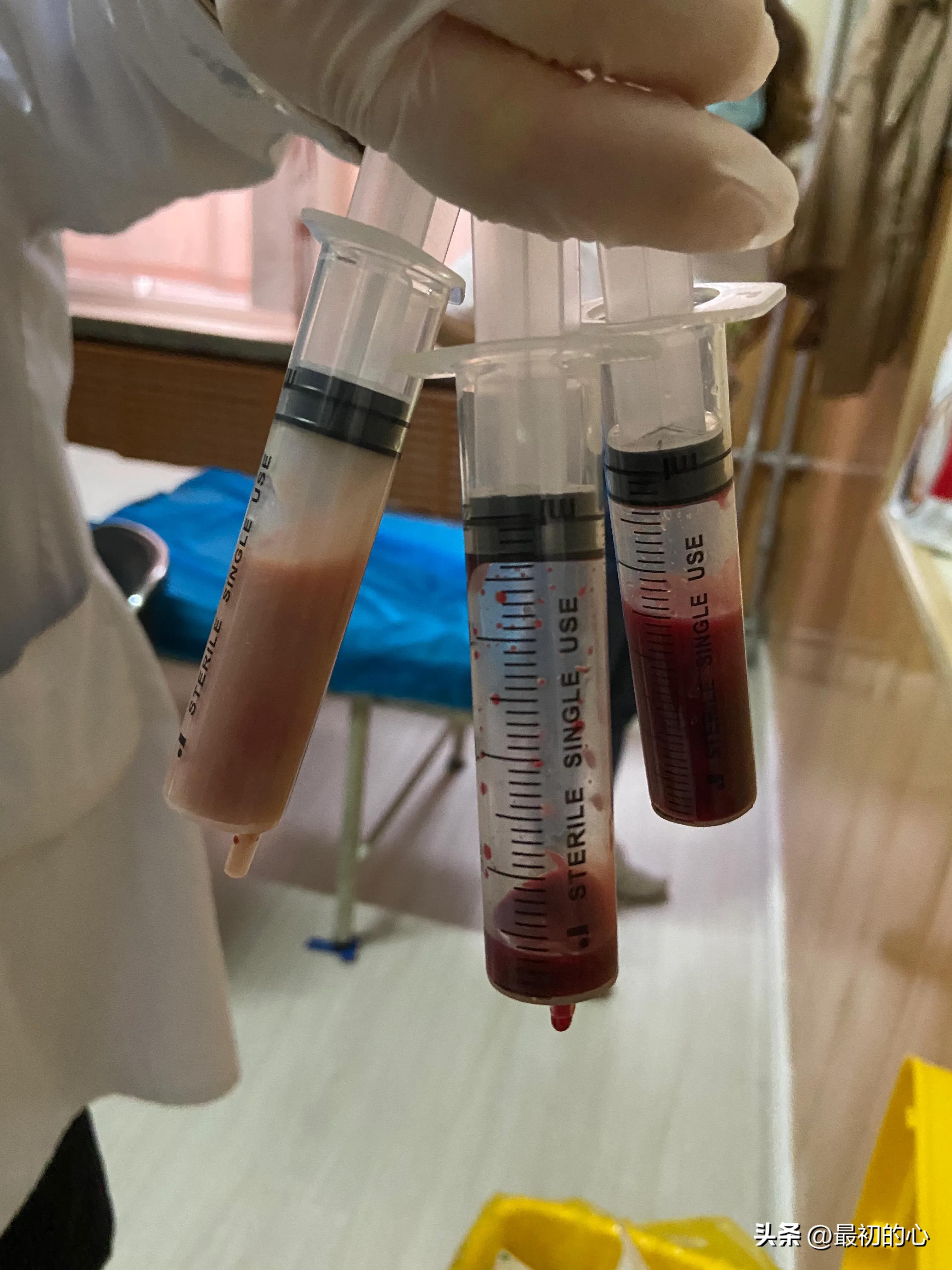 披荆斩棘的前行,披荆斩棘完整版