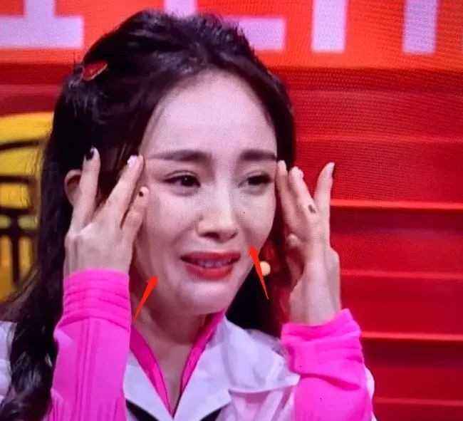 盘点整容失败惨不忍睹的30位女星,那些整容整失败的女明星