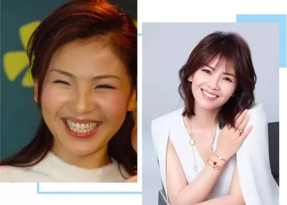 连屁股都是假的？假肩、假发、假腹肌，这些明星身上还有啥是真的