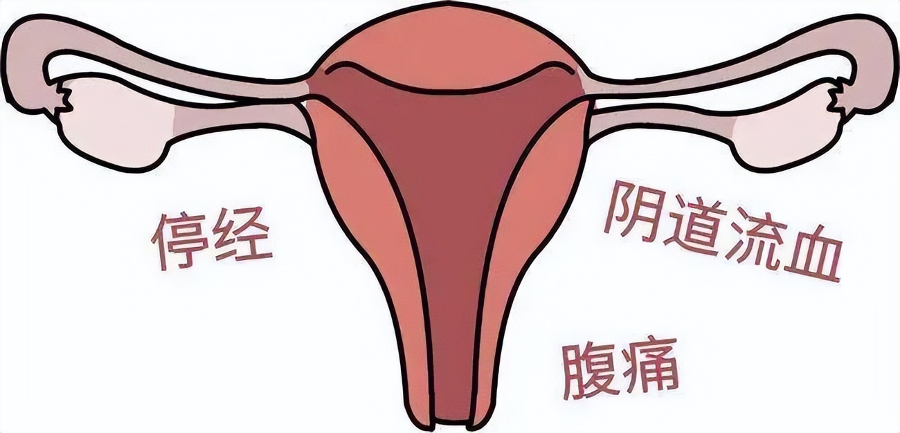 有这些症状女性一定要及时做检查,女性出现这些症状小心卵巢健康