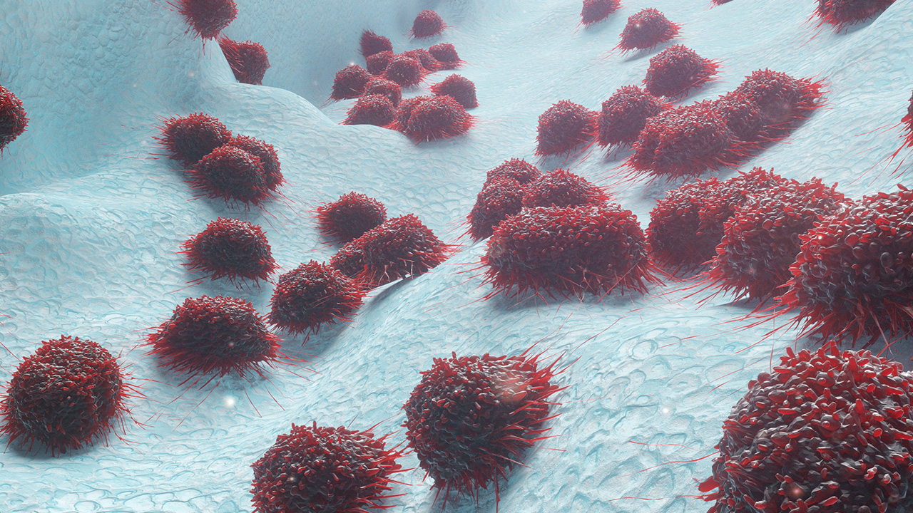 子宫内膜增厚和乳房疼有关系吗,子宫内膜增厚乳房胀痛