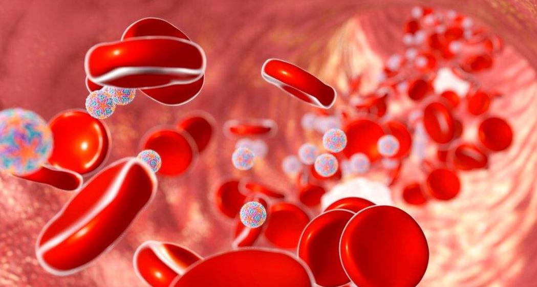 体检中查出胆红素偏高怎么办,体检胆红素增高怎么解决