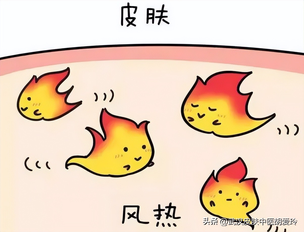 腿上突然起密集的小红疙瘩非常痒,脚腿上突然起红疙瘩很痒怎么回事