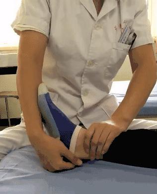 脚踝足内翻可以恢复吗,后天足内翻走路姿势