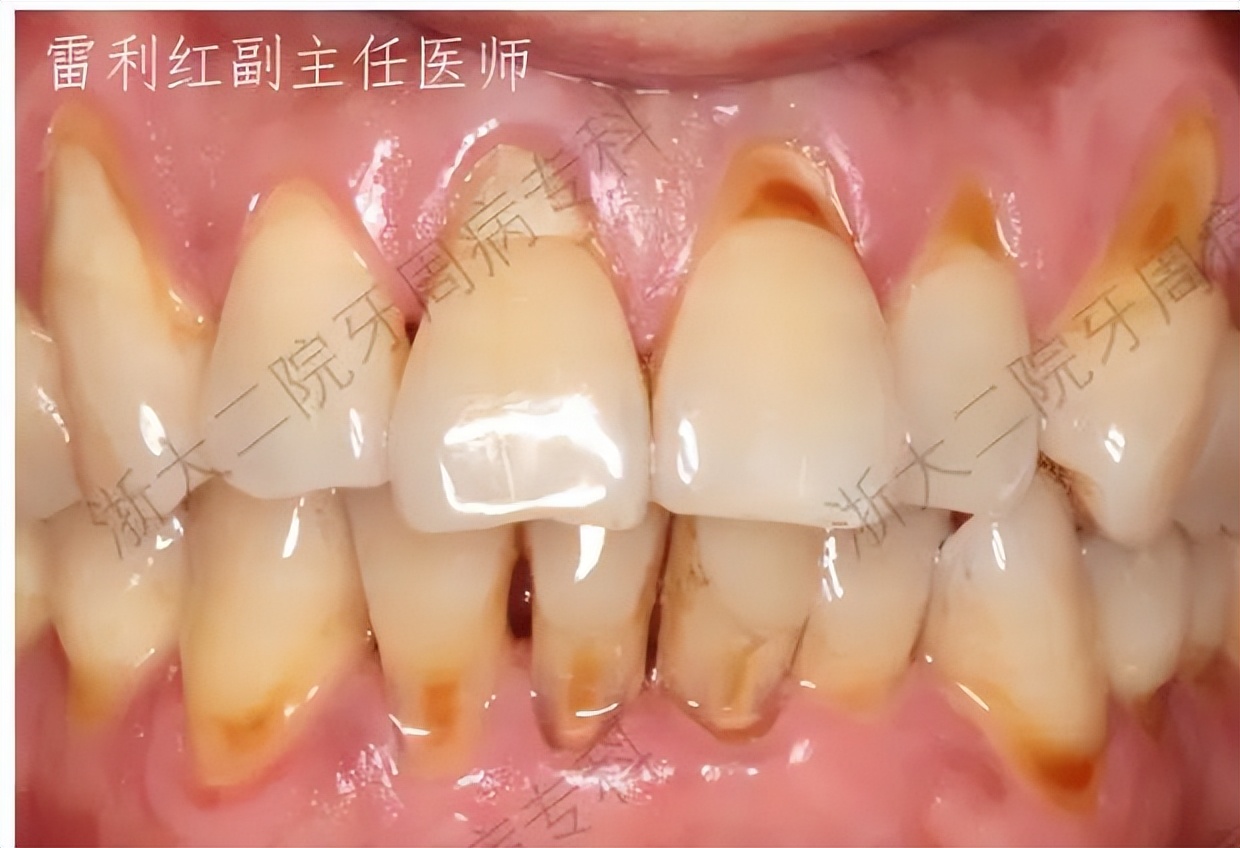 怎么拯救脱发小仙女,如何拯救牙齿上的黑洞