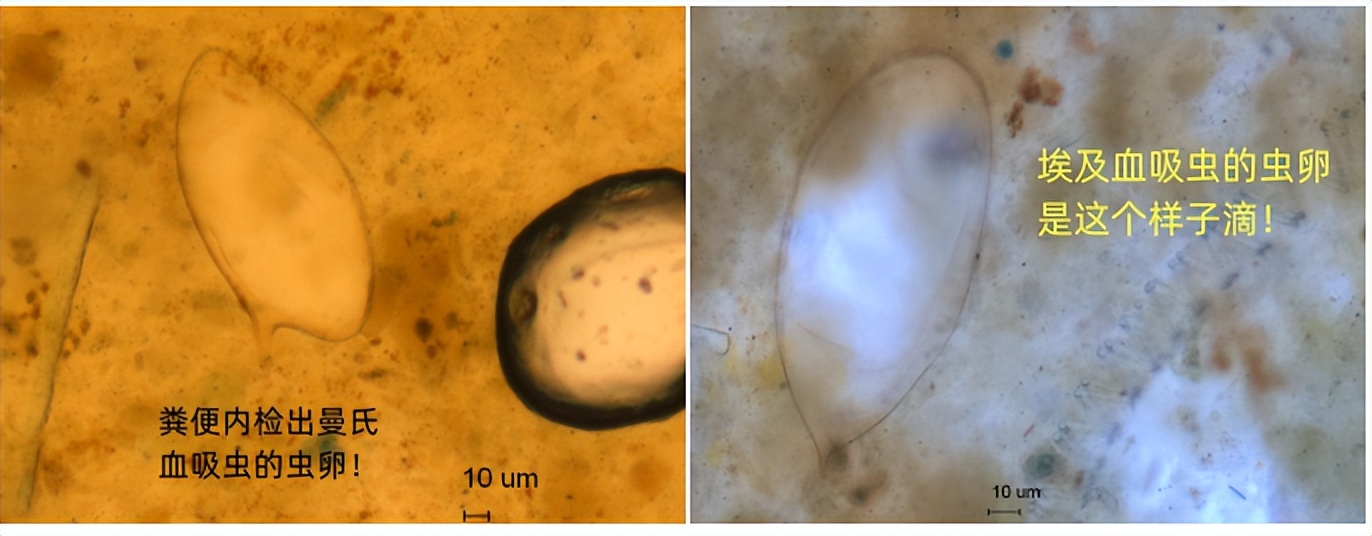 如果同时得了几种寄生虫病怎么治,现在寄生虫有哪些