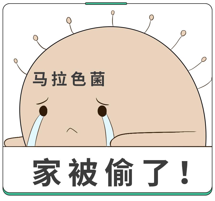 头皮屑是不是因为洗发水的原因,头皮屑多掉发和洗发水有关吗