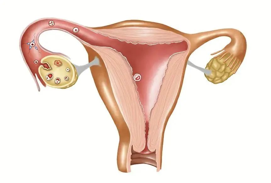 第二次试管移植冻胚的流程,试管第二胎移植流程