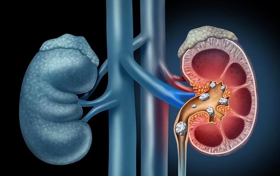 吃腰子羊鞭羊蛋这些真的会补肾吗,是吃腰子补肾好还是枸杞泡茶好点