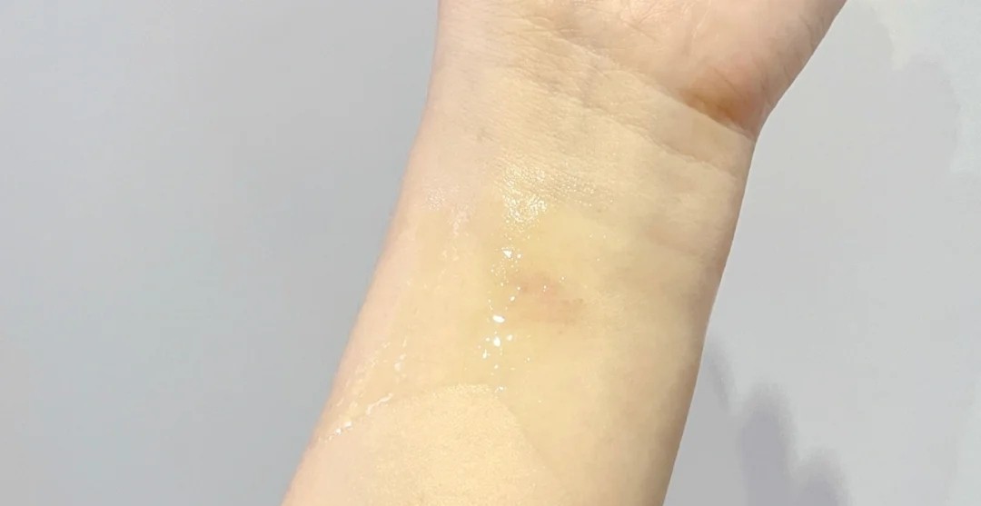 油性皮肤适合用的精华推荐,适合油敏肌秋冬用的精华油