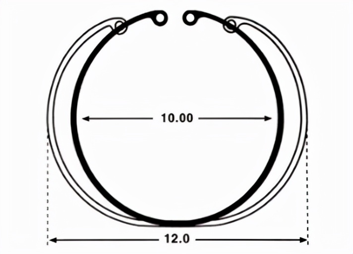 囊袋张力环植入过程,囊袋张力环优缺点