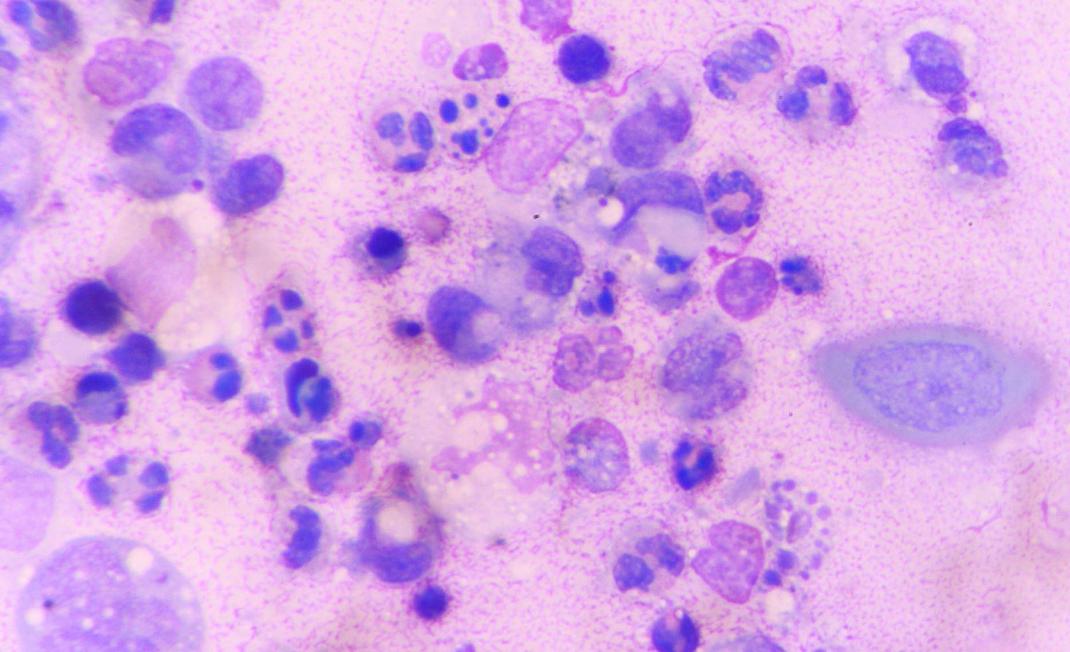 带状性疱疹的疼痛有何方法治疗,头上长带状疱疹怎么才能快速治愈