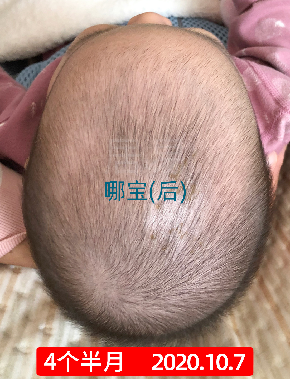 菱形头宝宝头型怎么矫正,上尖下扁头型宝宝头型怎么调整