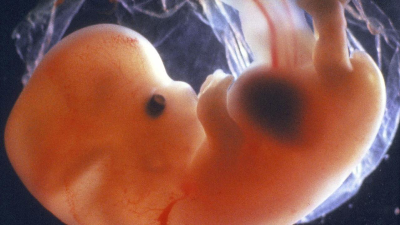 小孩身上的红痣可能是血管瘤,幼儿身上小红点富贵痣竟是血管瘤