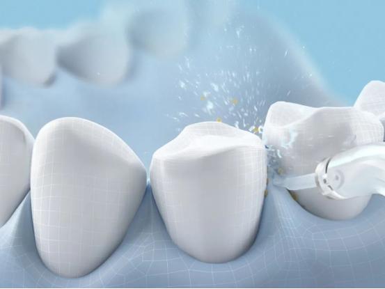 水牙线冲牙器品牌哪个好用,护牙神器水牙线测评