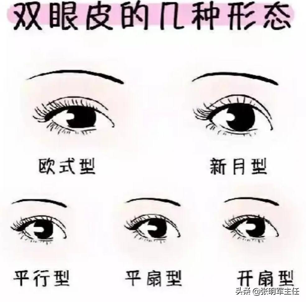 眼皮耷拉、松弛、三角眼，医生建议用两种方法改善